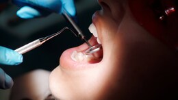 Woman Sues Dentist For Performing Over 30 Surgical Procedures In A Visit