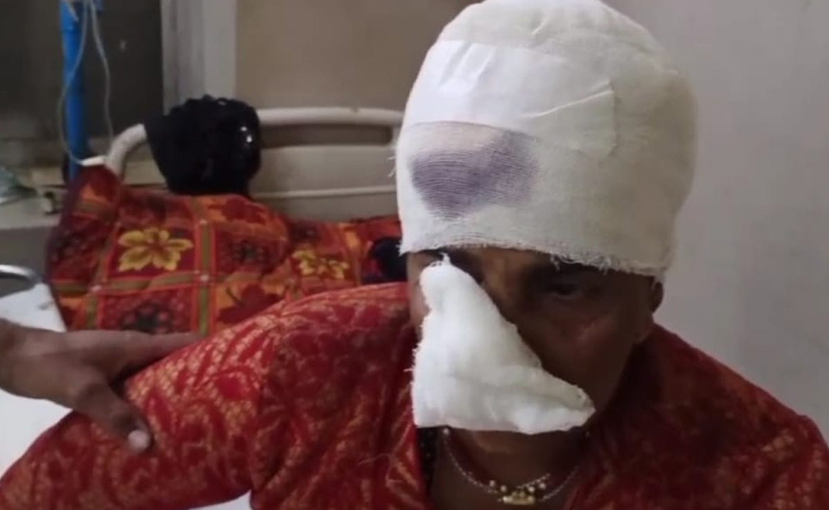 शादीशुदा महिला के पूर्व पति ने काटी सास की नाक, बड़ी मुश्किल से जुड़ी कटी नाक