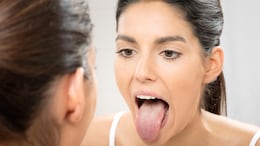 Doctor Explains What Your Tongue Reveals About Your Health