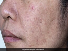 मुल्तानी मिट्टी के ये 4 फेस पैक्स चेहरे के दाग-धब्बे करते हैं कम, चुटकियों में बनाकर लगा सकते हैं मुल्तानी मिट्टी के ये 4 फेस पैक्स चेहरे के दाग-धब्बे करते हैं कम, चुटकियों में बनाकर लगा सकते हैं