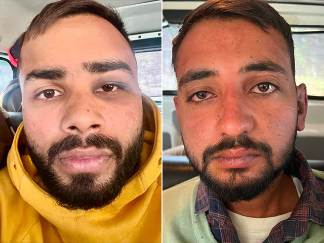 Clash Between Punjab Cops And Car Thieves In Mohali, 2 Arrested