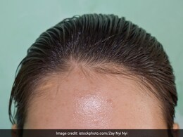क्या ऑयली हेयर वालों को तेल नहीं लगाना चाहिए? आयुर्वेदिक एक्सपर्ट ने बताया क्या करें