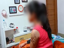 दिल्ली में अमेरिकन बुली नस्ल के कुत्ते ने बच्ची पर किया बुरी तरह हमला, केस दर्ज दिल्ली में अमेरिकन बुली नस्ल के कुत्ते ने बच्ची पर किया बुरी तरह हमला, केस दर्ज