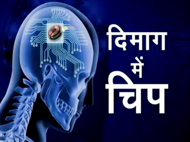 Elon Musk की कंपनी न्यूरालिंक ने लगाया दिमाग में चिप, 6 महीने तक मेडिकल निगरानी में रहेगा मरीज