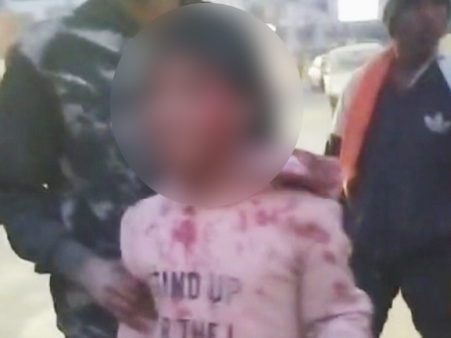 Leopard Attacks Child On Dehradun's Canal Road