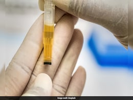 Scientists Solve Mystery Behind What Makes Urine Yellow Scientists Solve Mystery Behind What Makes Urine Yellow