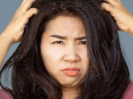 Home Remedies: डैंड्रफ से हैं परेशान, चुटकी भर Baking Soda में छिपा है समाधान, ऐसे करें इस्तेमाल Home Remedies: डैंड्रफ से हैं परेशान, चुटकी भर Baking Soda में छिपा है समाधान, ऐसे करें इस्तेमाल