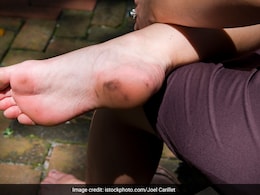 दिनभर रहती है सुस्ती और आलस? क्या शरीर में कोलेस्ट्रॉल बढ़ने पर लगती है ज्यादा थकान? जानिए डॉक्टर ने क्या कहा दिनभर रहती है सुस्ती और आलस? क्या शरीर में कोलेस्ट्रॉल बढ़ने पर लगती है ज्यादा थकान? जानिए डॉक्टर ने क्या कहा