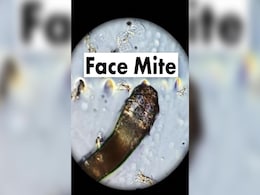 इस वक्त आपके चेहरे पर रेंग रहे हैं आठ पैर वाले हजारों कीड़े, स्किन में घुसकर भरते हैं पेट, छुआ लिया तो... इस वक्त आपके चेहरे पर रेंग रहे हैं आठ पैर वाले हजारों कीड़े, स्किन में घुसकर भरते हैं पेट, छुआ लिया तो...