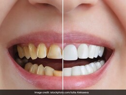 दूध की तरह चमकने लगेंगे दांत, घर पर 20 रु की इन दो चीजों से बनाएं टूथपेस्ट, जड़ से निकल जाएगी पीली परत दूध की तरह चमकने लगेंगे दांत, घर पर 20 रु की इन दो चीजों से बनाएं टूथपेस्ट, जड़ से निकल जाएगी पीली परत