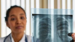 What Is A Tripledemic? Lookout For These Three Viruses That Cause Severe Respiratory Health Issues