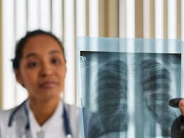 What Is A Tripledemic? Lookout For These Three Viruses That Cause Severe Respiratory Health Issues What Is A Tripledemic? Lookout For These Three Viruses That Cause Severe Respiratory Health Issues