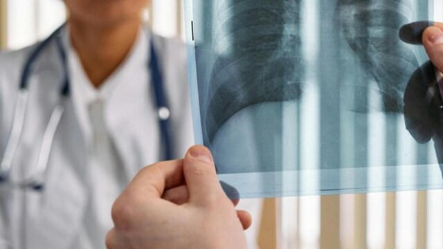 3 severe respiratory health risks during seasonal changes