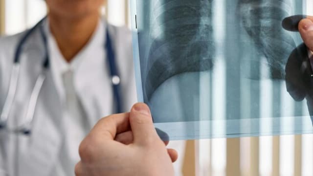3 severe respiratory health risks during seasonal changes
