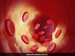 सुबह की ये 5 आदतें घटा देंगी बुरा कॉलेस्ट्रोल, High Cholesterol से परेशान लोगों को जरूर रखना चाहिए इन बातों का ध्यान  सुबह की ये 5 आदतें घटा देंगी बुरा कॉलेस्ट्रोल, High Cholesterol से परेशान लोगों को जरूर रखना चाहिए इन बातों का ध्यान