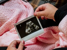 Pregnancy Swelling : प्रेगनेंसी में हाथ -पैर सूजने के होते हैं ये कारण, इन घरेलू उपायों से स्वेलिंग कर सकती हैं कम Pregnancy Swelling : प्रेगनेंसी में हाथ -पैर सूजने के होते हैं ये कारण, इन घरेलू उपायों से स्वेलिंग कर सकती हैं कम