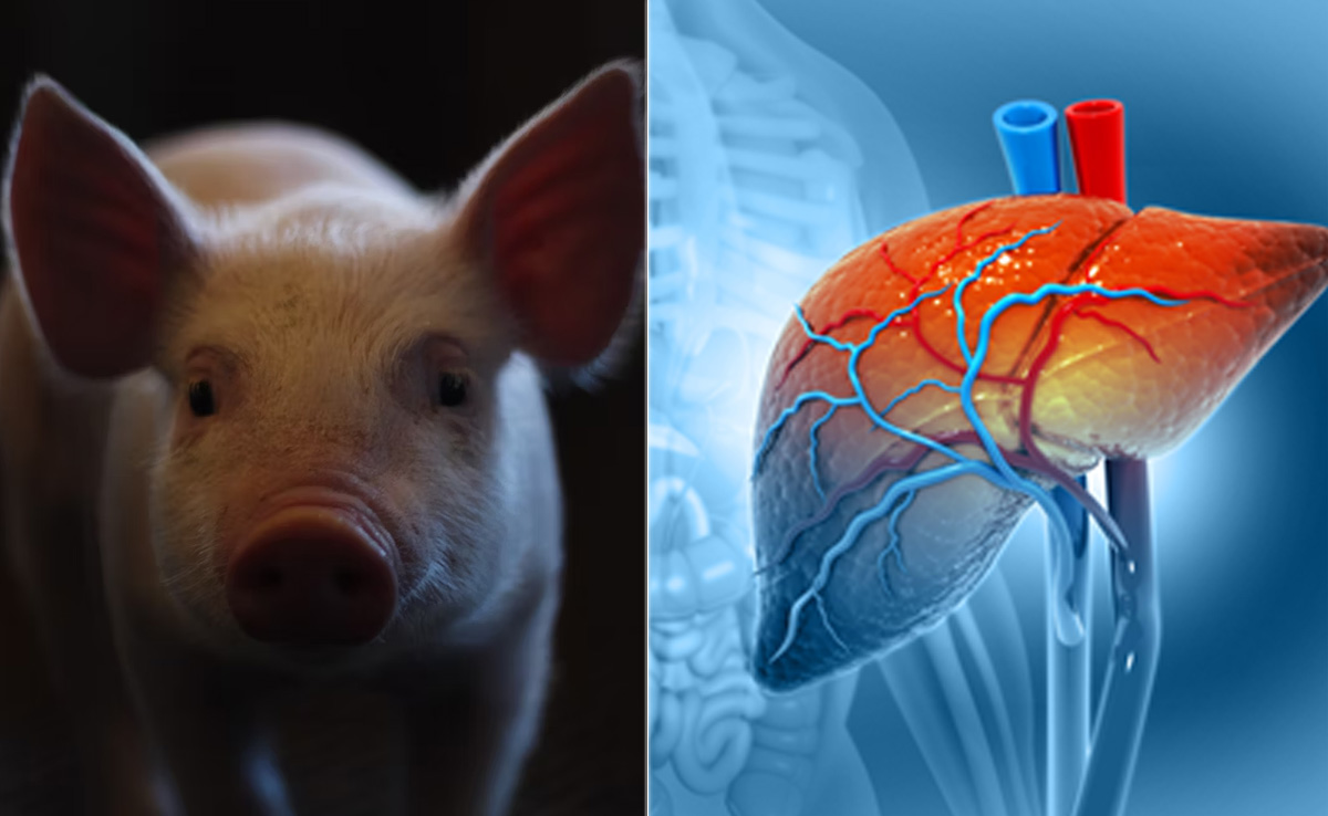 Pig Liver Successfully Filters Blood In Brain-Dead Body, Paving Way For Future Xenotransplants