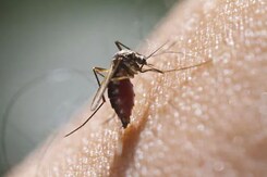 World's 1st Malaria Vaccine Rolled Out For Children In Africa World's 1st Malaria Vaccine Rolled Out For Children In Africa