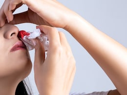 गर्मियों में क्यों आता है नाक से खून और क्या है इसका इलाज, डॉक्टर से जानें... गर्मियों में क्यों आता है नाक से खून और क्या है इसका इलाज, डॉक्टर से जानें...