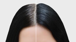 5 Natural Remedies To Protect Your Hair From Premature Graying - You Need To See No. 3