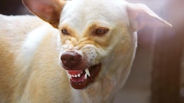 First Aid Tips For Dog Bites: What You Should Know