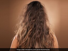 डर्मेटोलॉजिस्ट ने बताया किस तरह मॉनसून में फ्रिजी बालों का रखा जा सकता है ख्याल, उलझे हुए नहीं दिखेंगे बाल  डर्मेटोलॉजिस्ट ने बताया किस तरह मॉनसून में फ्रिजी बालों का रखा जा सकता है ख्याल, उलझे हुए नहीं दिखेंगे बाल