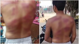 MP के भिंड में सरेआम गुंडागर्दी ! अगवा करने के बाद दबंगों ने युवक को दी थर्ड डिग्री
