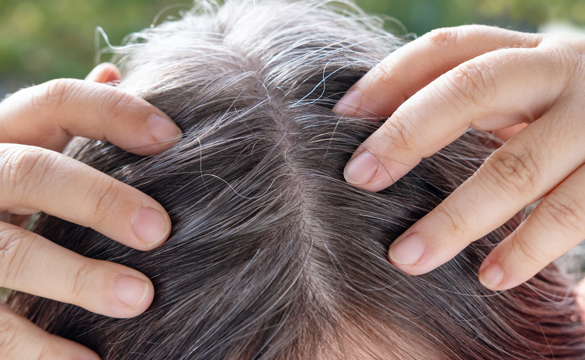 Coconut Oil Benefits: क्या आप भी सफेद बालों की समस्या से हैं परेशान? ये रहा समाधान...