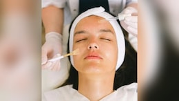 चेहरे पर आ रही फाइनलाइन्स तो डाइट में शामिल कर लें ये फल, सोने की तरह दमकेगी त्वचा