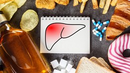 Can Eating Junk Food Increase The Risk Of These Common Fatty Liver diseases?