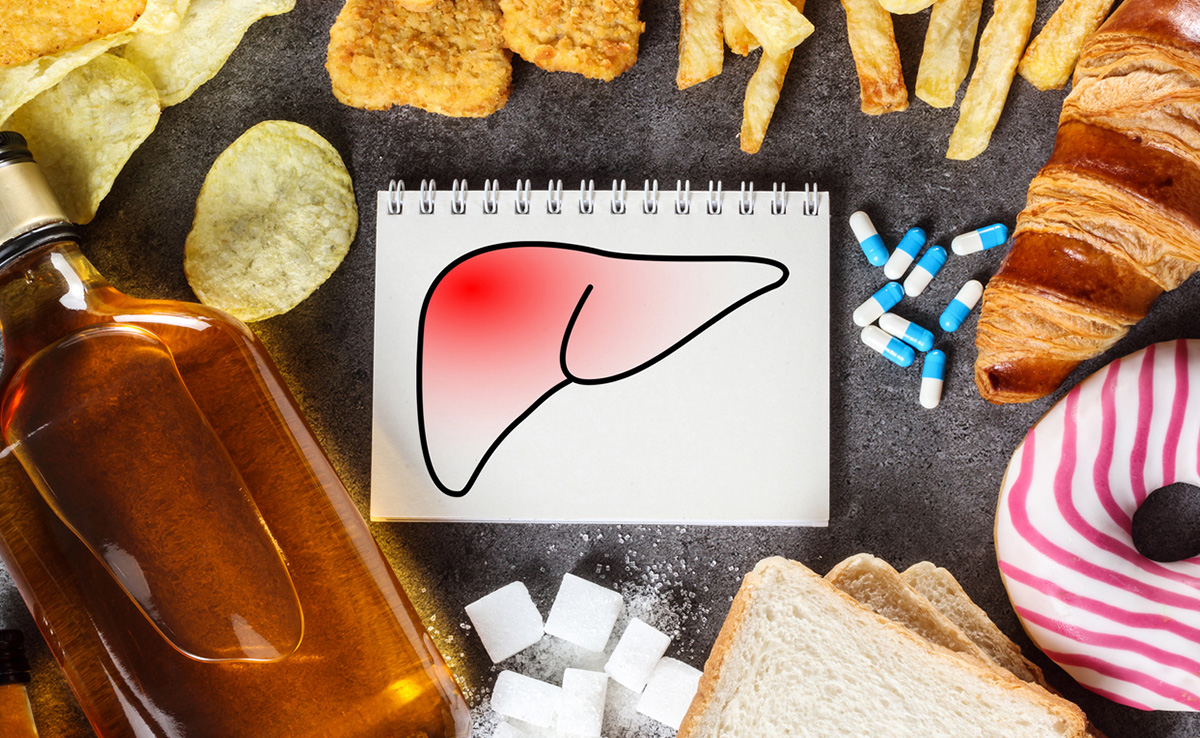 Can Eating Junk Food Increase The Risk Of These Common Fatty Liver diseases?