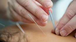 Kerala Woman Dies After Husband Lets Acupuncturist Deliver Baby: Cops