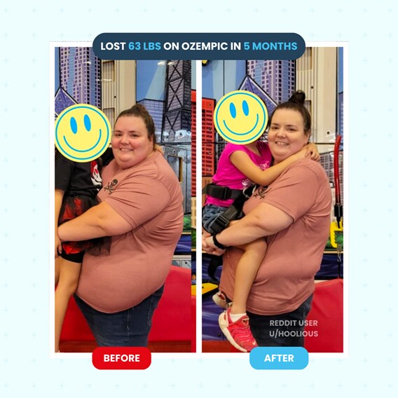 Ozempic Weight Loss Reviews Before And After Photos