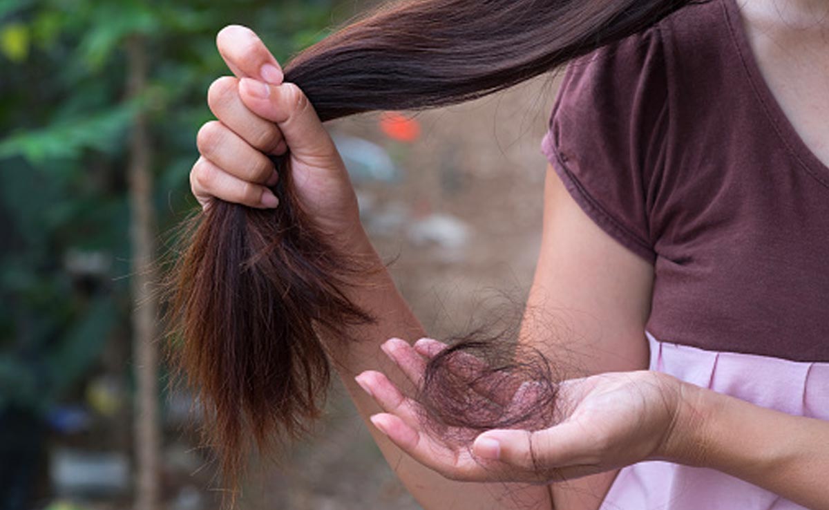 जरूरत से ज्यादा झड़ने लगे हैं बाल और गुच्छा भर टूटकर गिरते हैं रोज, तो इन चीजों को लगाना कर दीजिए शुरू