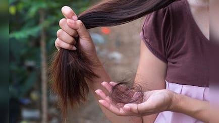 किस विटामिन की कमी से बाल नहीं बढ़ते हैं? डॉक्टर ने बताया सच!