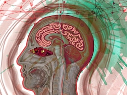 Brain stroke : जानिए क्यों होता है ब्रेन स्ट्रोक और क्या होते हैं इसके लक्षण