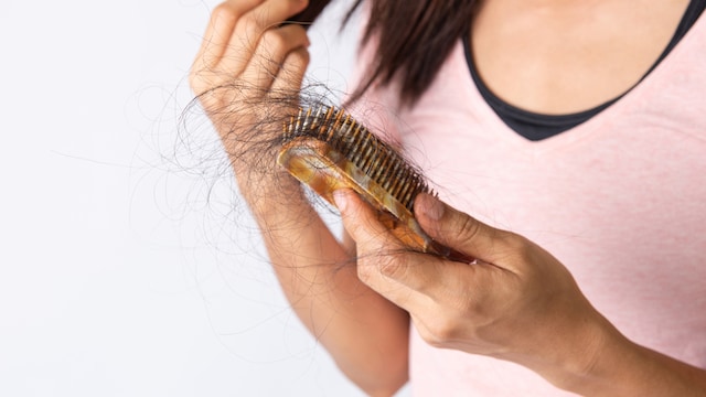 In cases of significant hair loss, wigs or hairpieces can be a practical solution