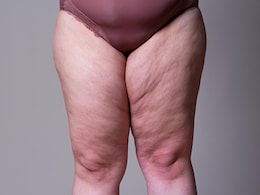 पैर नजर आते हैं बहुत मोटे तो करिए 3 योगासन, कुछ दिन में शेप में आ जाएंगे आपके Leg पैर नजर आते हैं बहुत मोटे तो करिए 3 योगासन, कुछ दिन में शेप में आ जाएंगे आपके Leg