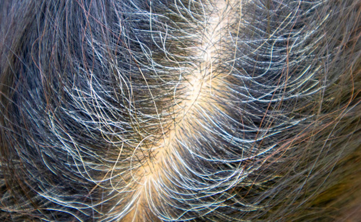 White Hair Treatment: सफेद बाल छिपाते-छिपाते हो गए हैं परेशान, हम लेकर आए हैं आपके लिए घरेलू समाधान