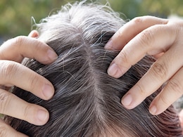 सफेद बालों को काला कर देगा सरसो के तेल का यह नुस्खा, बस इस चीज को मिलाकर लगा लीजिए जड़ों में सफेद बालों को काला कर देगा सरसो के तेल का यह नुस्खा, बस इस चीज को मिलाकर लगा लीजिए जड़ों में