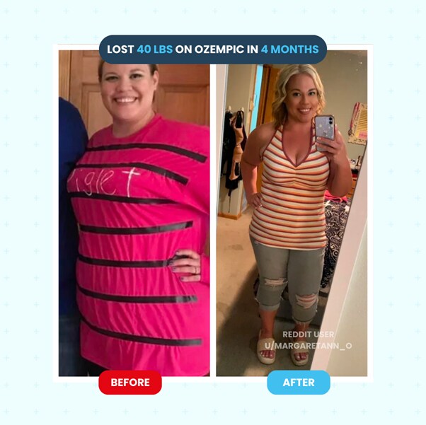 Ozempic Weight Loss Reviews Before And After Photos