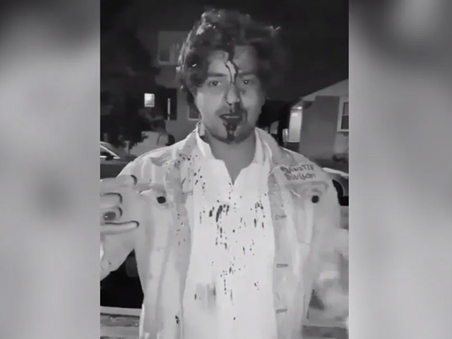 "Please Help": Indian Student Bleeds Profusely In Video After Attack In US