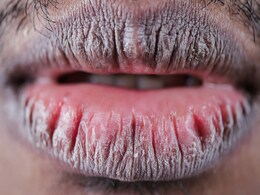 Reason Behind Black lips : ये 5 बड़ी वजह होती हैं आपके होंठ के कालेपन की, जानिए यहां Reason Behind Black lips : ये 5 बड़ी वजह होती हैं आपके होंठ के कालेपन की, जानिए यहां