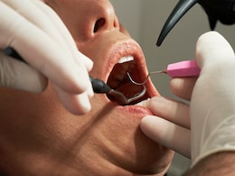 Kerala Dentist Ordered To Pay Rs 2 Lakh For Damaging Patient's Five Teeth Kerala Dentist Ordered To Pay Rs 2 Lakh For Damaging Patient's Five Teeth