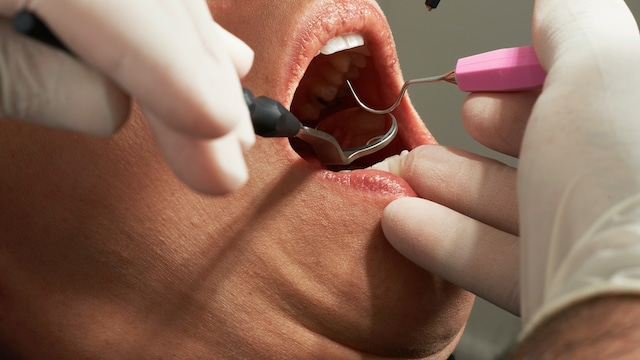 Methemoglobinemia affects how red blood cells provide oxygen to cells and tissues