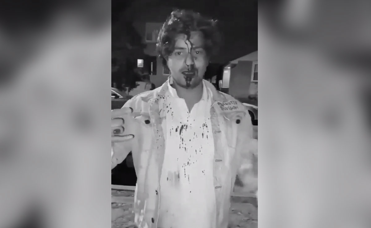 "Please Help": Indian Student Bleeds Profusely In Video After Attack In US