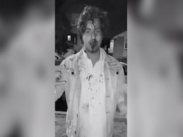 "Please Help": Indian Student Bleeds Profusely In Video After Attack In US "Please Help": Indian Student Bleeds Profusely In Video After Attack In US