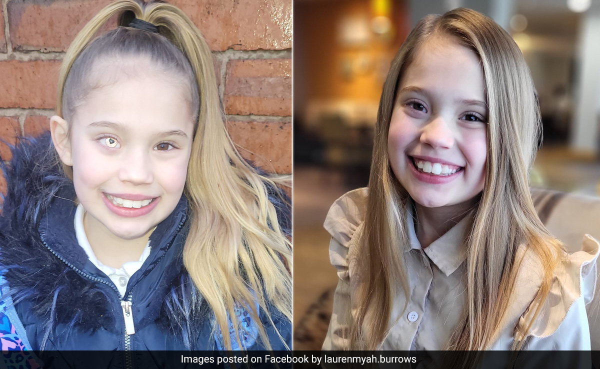 UK Girl, 9, Who Was Bullied For Having Only Eye Gets A Bionic Replacement