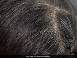 बच्चों के बाल छोटी उम्र में ही ना हो जाएं सफेद इसलिए खिलाना शुरू कर दीजिए ये 5 चीजें, नहीं सताएगी कभी White Hair की दिक्कत बच्चों के बाल छोटी उम्र में ही ना हो जाएं सफेद इसलिए खिलाना शुरू कर दीजिए ये 5 चीजें, नहीं सताएगी कभी White Hair की दिक्कत