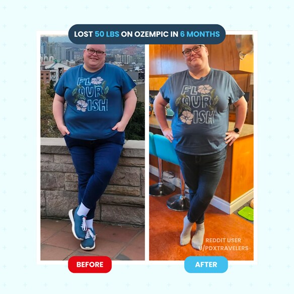 Ozempic Weight Loss Reviews Before And After Photos